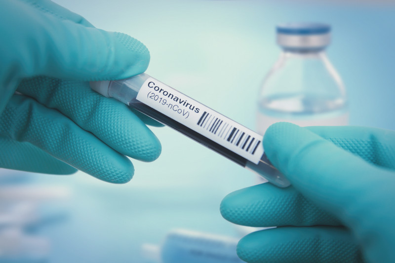 Three Key Coronavirus-Related Strategic Risks to Consider